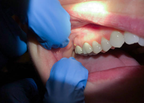 Best Broken Tooth Emergency  in Grandyle Village, NY